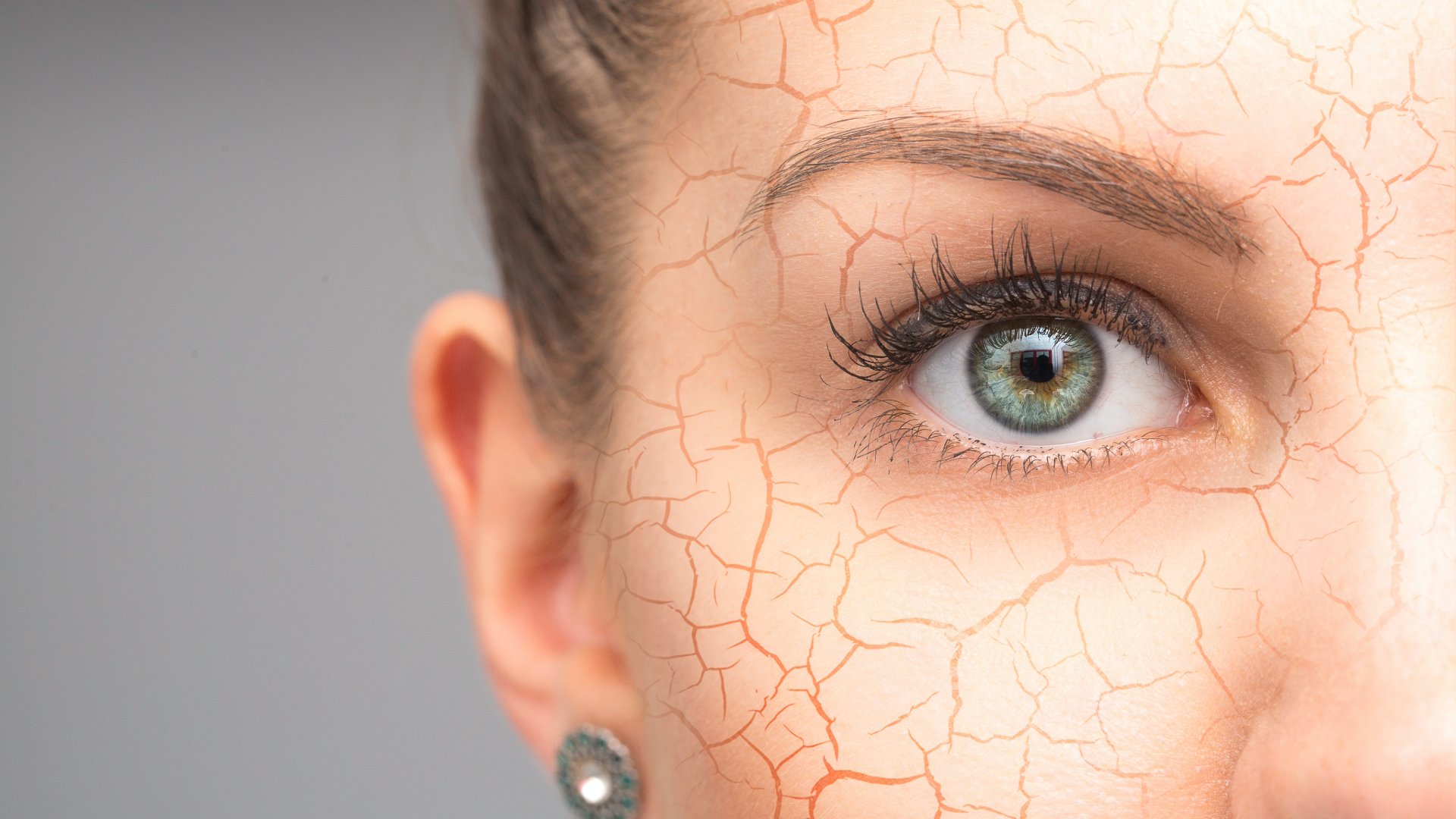 Close-up of a woman's face showing severe dry skin effects with visible cracks.